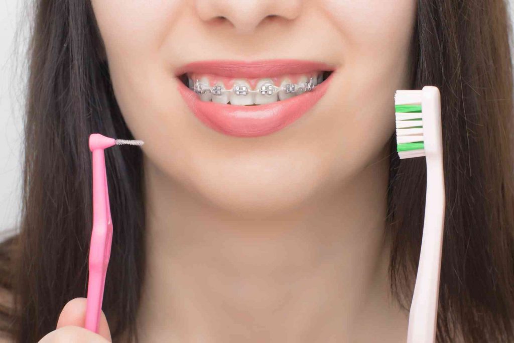 diş teli temizliği ve bakımı