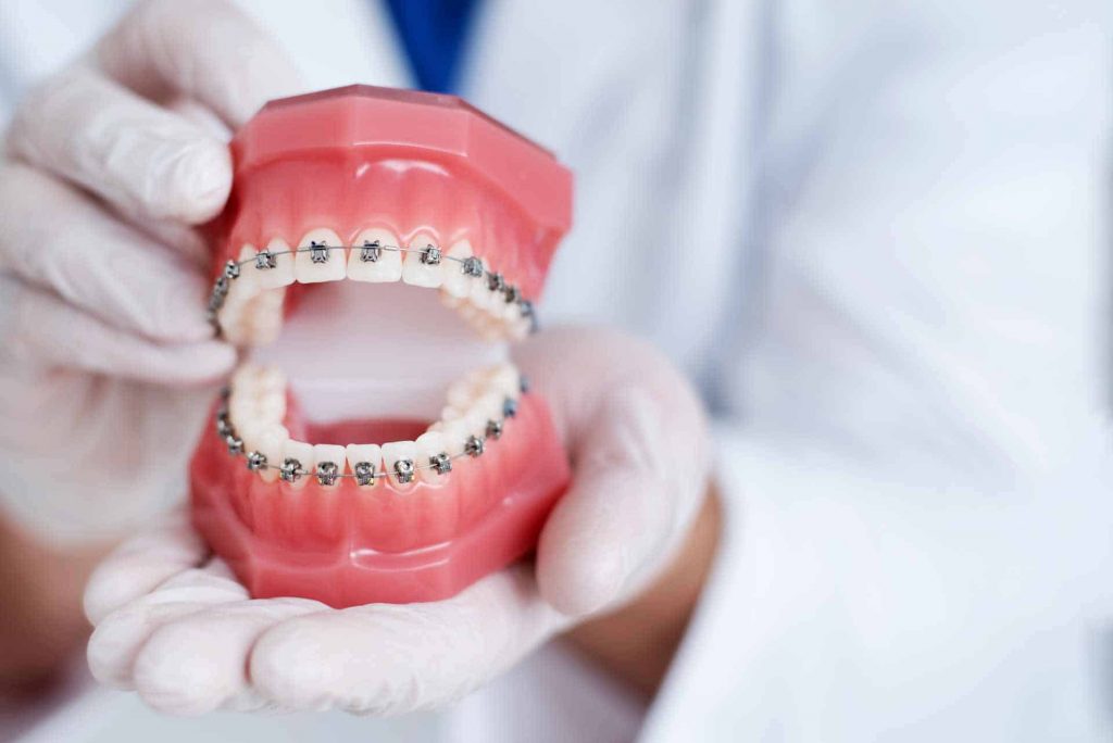 ortodonti tedavisi fiyatları