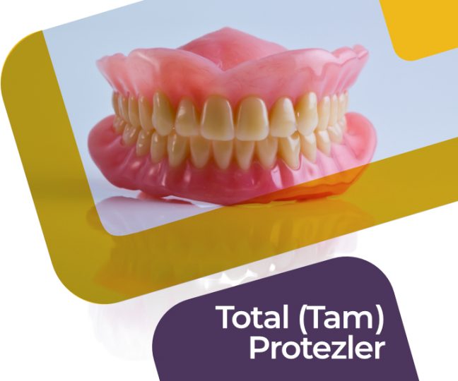 total protez damak diş